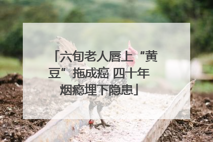 六旬老人唇上“黄豆”拖成癌 四十年烟瘾埋下隐患
